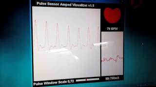 Icstation Pulssensor