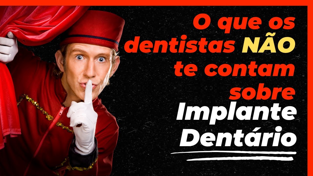 O QUE OS DENTISTAS NÃO TE CONTAM SOBRE IMPLANTE DENTÁRIO