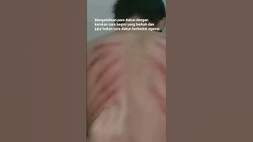 kerokan masuk angin terbaru#shorts