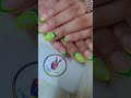 Subtle French tips with unique brush patterns and 3D Lemon art Book your slot today!Call@06284880015