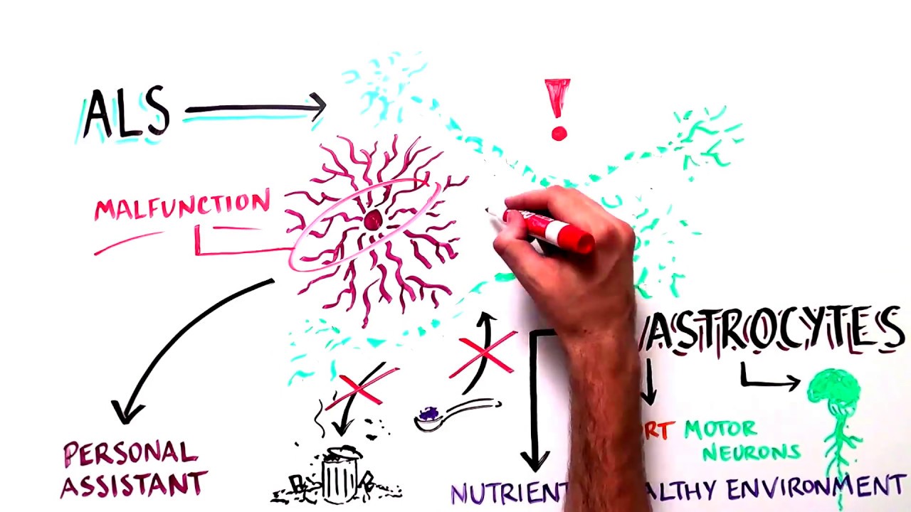 Progress and Promise of Stem Cell Research: Lou Gehrig's Disease/ALS