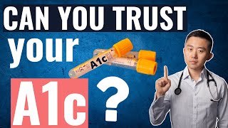 Is A1c the right test for you?