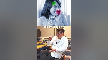 Onlay vs Resin Filling—Here’s What Dentists Actually Recommend 👀🦷