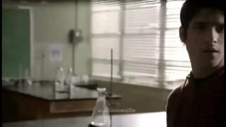 Scallison Worst Moments