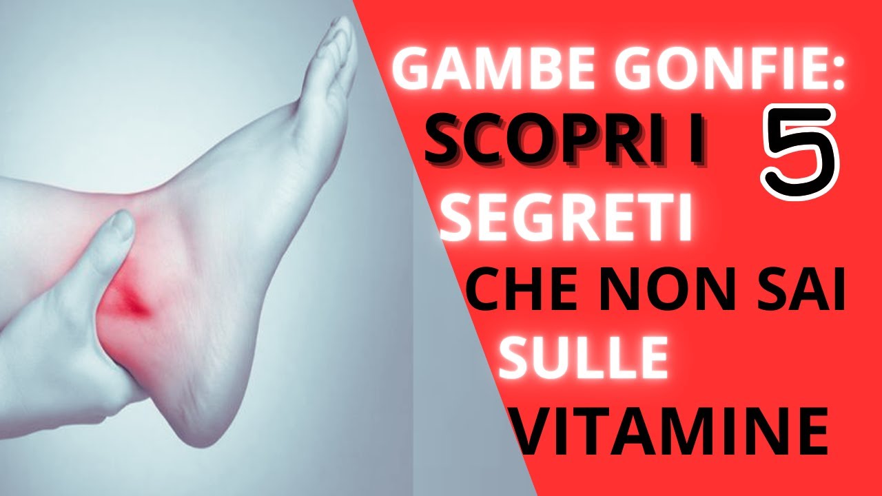 Gambe gonfie: scopri i 5 segreti che non sai sulle vitamine!😲 - YouTube
