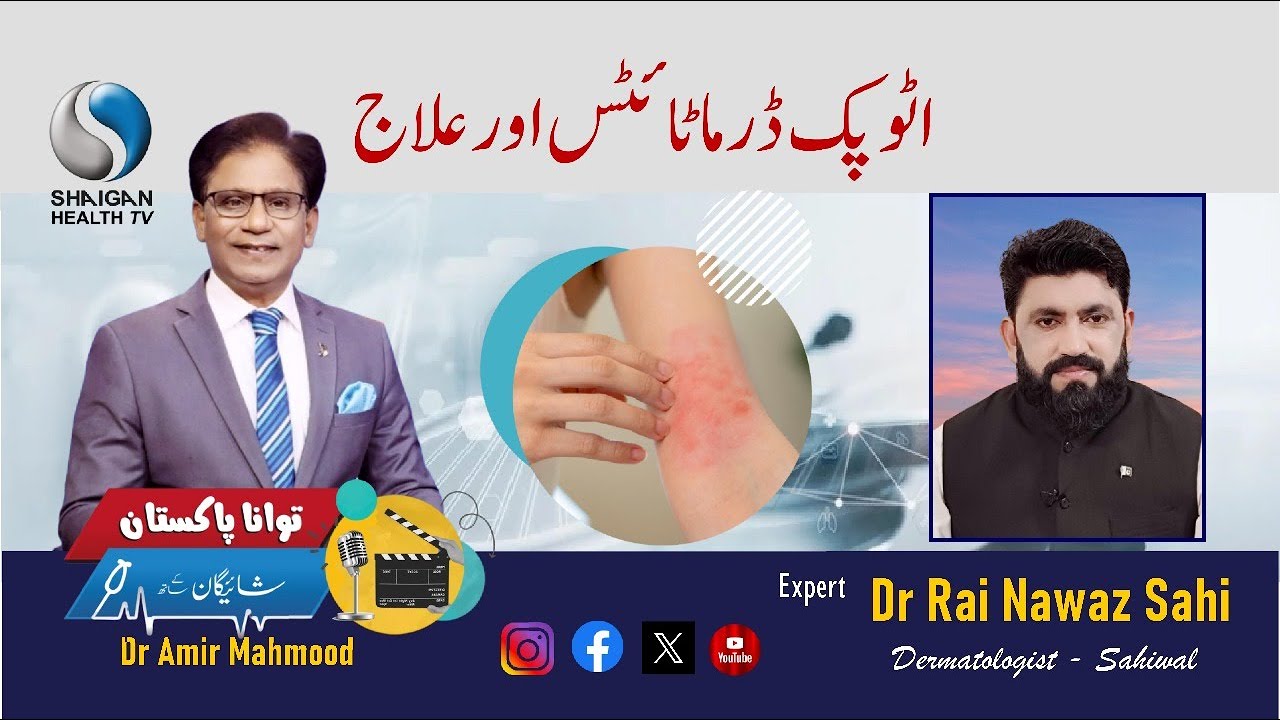 Atopic Dermatitis & Eczema Relief | Dr. Rai Nawaz Sahi | TAWANA PAKISTAN – Shaigan Kay Sath