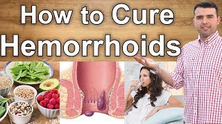 How to Cure Hemorrhoids Naturally – Causes, Diet and Natural Treatments