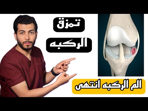 افضل الطرق الفعالة 100 لعلاج تمزق أربطة الركبة وقطع غضروف الركبه كيفية تخفيف الم الركبه بعد السقوط