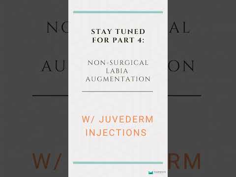 Non-Surgical Labia Augmentation with alloClae & Leneva | Part 3: Filler & Fat Matrix Injections 💉✨