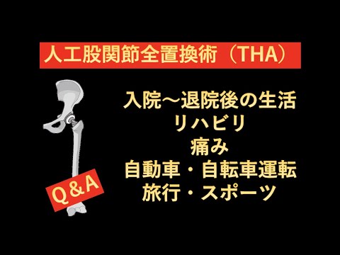 人工股関節全置換術 2nd Decade of the 21st Century 人工股関節全置換術 2nd Decade of the 21st Century 人工股関節