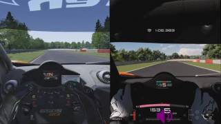 Sound comparison of the mclaren 650s gt3 in assetto corsa and gt
sport, at nurburgring, nordschleife!