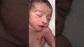Cute Preterm Baby in NICU – Just Born &amp; Receiving Nursing Care 🤲❤️ #PretermBaby #NICUCare🤲🙏❤️