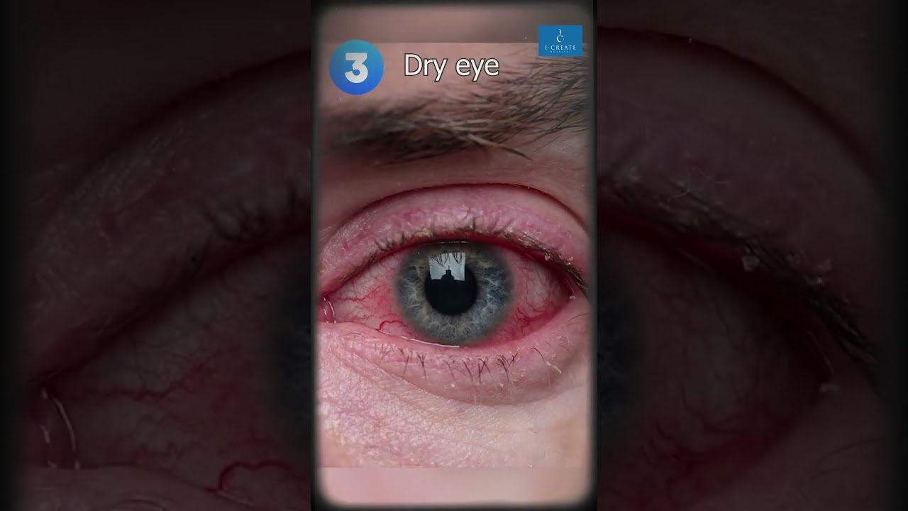 Ignoring eye problems can lead to serious complications!