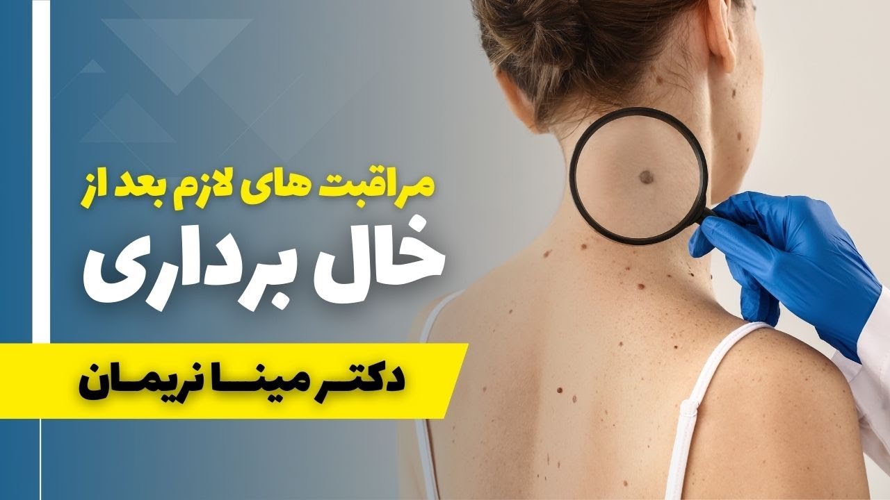 مراقبت های بعد از خال برداری / انجامش خیلی مهمه تا محل خال بعد از ریمو ...