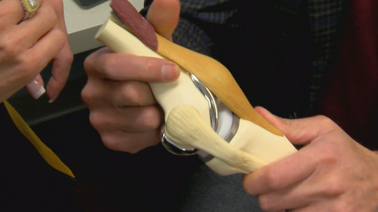 New study uses Apple Watch to help patients recovering from knee joint replacements