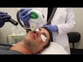 What is IPL? | How Does an IPL Intense Pulsed Light PHOTOFACIAL TREATMENT Work? | Pūr Skin Clinic Mp3 Song