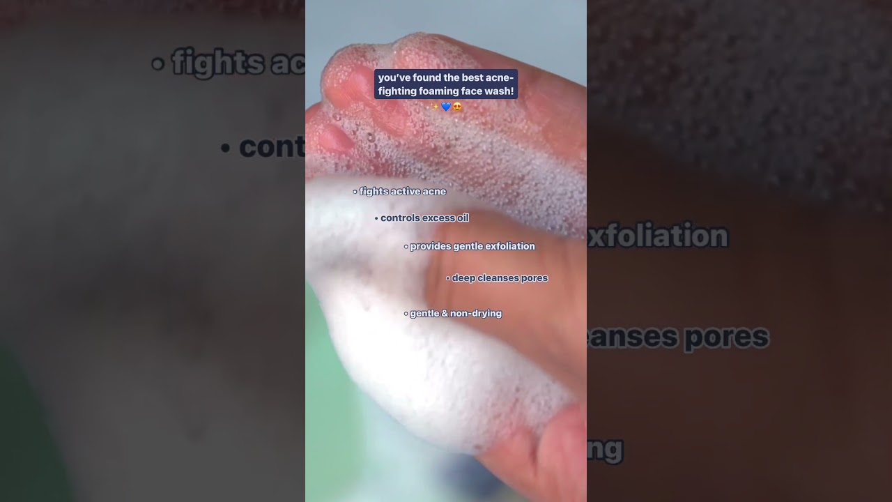 Need a Face Wash for Acne Prone Skin? Try this Salicylic Acid Face Wash 💙