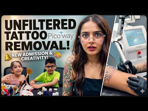 Why He Removed His Tattoo PicoWay Laser Explained + New Kids Batch