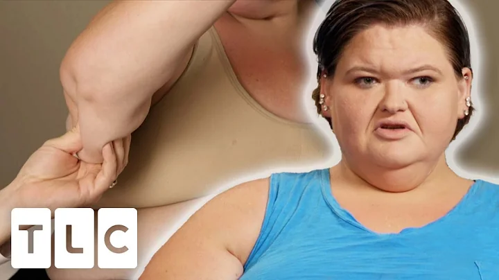 Amy Wants To Get Excess Skin Removal Surgery | 1000lb Sisters