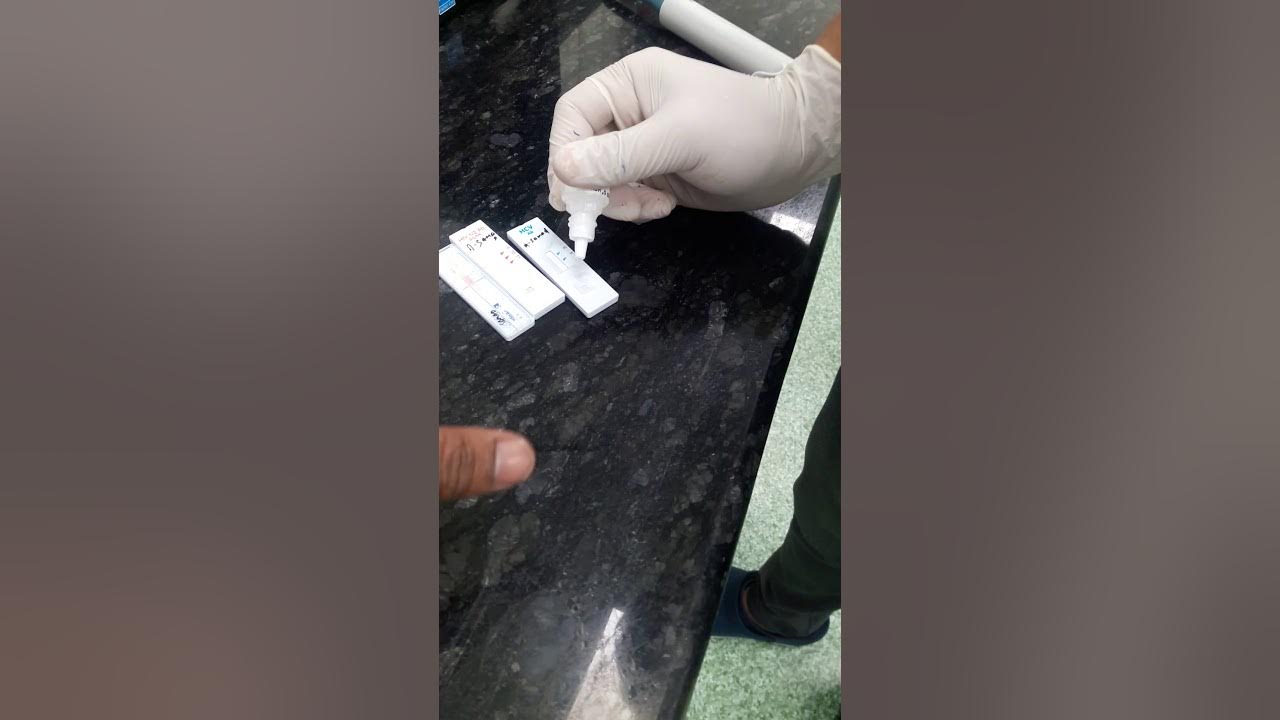 Serology Test, HBsAg,HIV YouTube