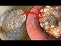 Why You Should Soak Chia Seeds Before Eating Them (Chia Seeds Side Effects)