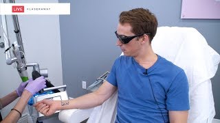 Laser Tattoo Removal Live Session At Laseraway