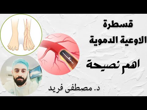 اهم نصيحة لو كنت تعاني من انسداد في شرايين الساق د مصطفى فريد