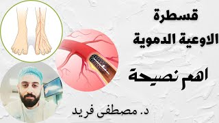 اهم نصيحة لو كنت تعاني من انسداد في شرايين الساق | د. مصطفى فريد