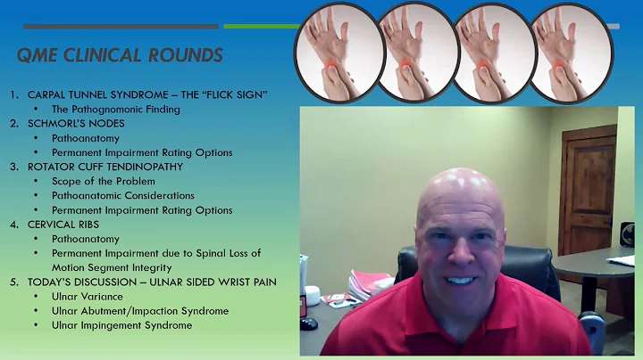 QME Clinical Rounds-Ulnar Sided Wrist Pain Perry J. Carpenter DC QME, www.ezcontinuingeducation.org