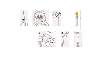 Hoe werkt een soa thuistest? | Keel | StadsKliniek