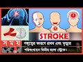        stroke  world stroke day  stroke treatment  somoy tv