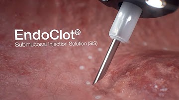 Olympus EndoClot (Medical 3D Animation)