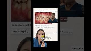 will orthodontic extractions flatten my face? #orthodontics #singapore