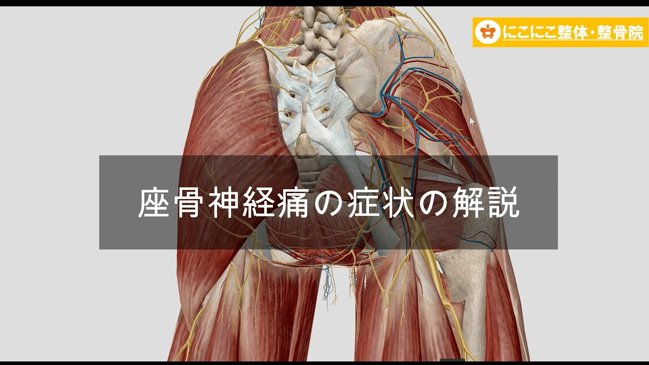座骨製神経痛 – 坐骨神経痛 どこに行けばいい – KBOUG