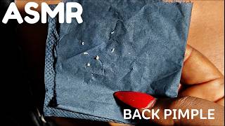 ASMR | Back Pimple Removal #asmr #pimplepopping #nitpicking #pimple #asmrsounds  #bedtimestories