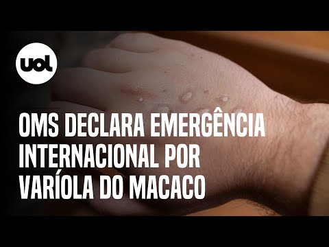 OMS declara emergência internacional por varíola do macaco