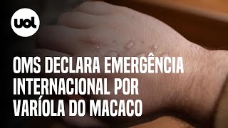 Disseminação global da varíola do macaco em 2022 serve de alerta