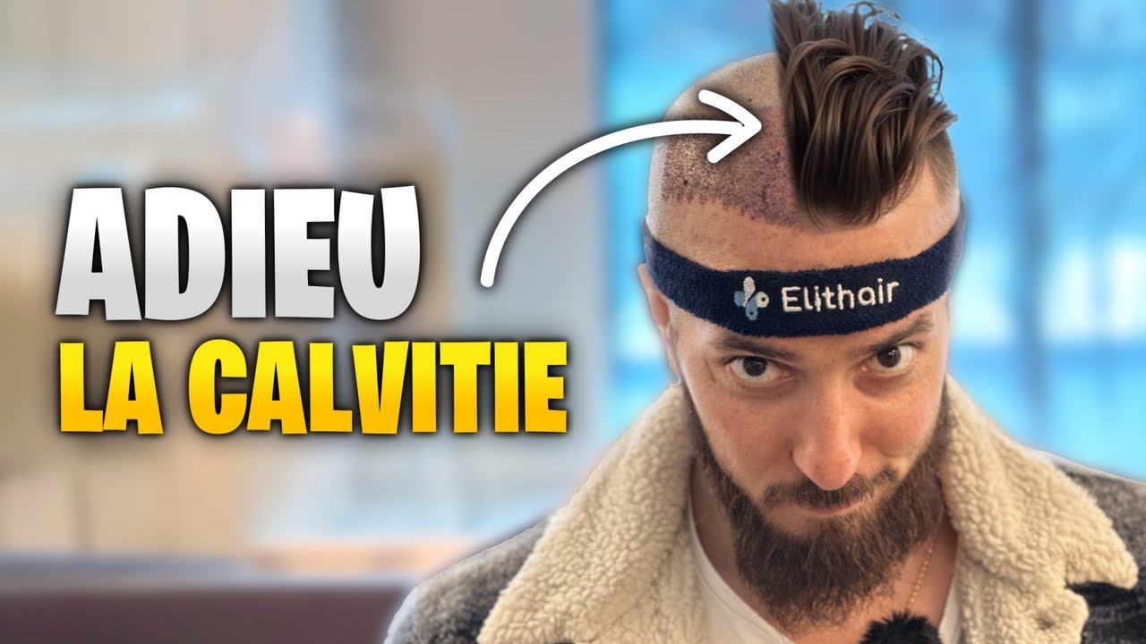 JE CORRIGE MA GREFFE RATÉE