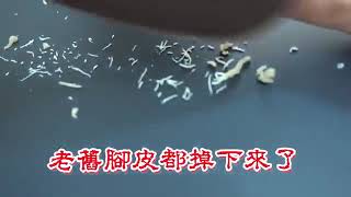 Foot File Foot Callus Remover