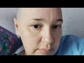 🍃Побочки после химиотерапии / жизнь в диагнозе онкология🍂🍃