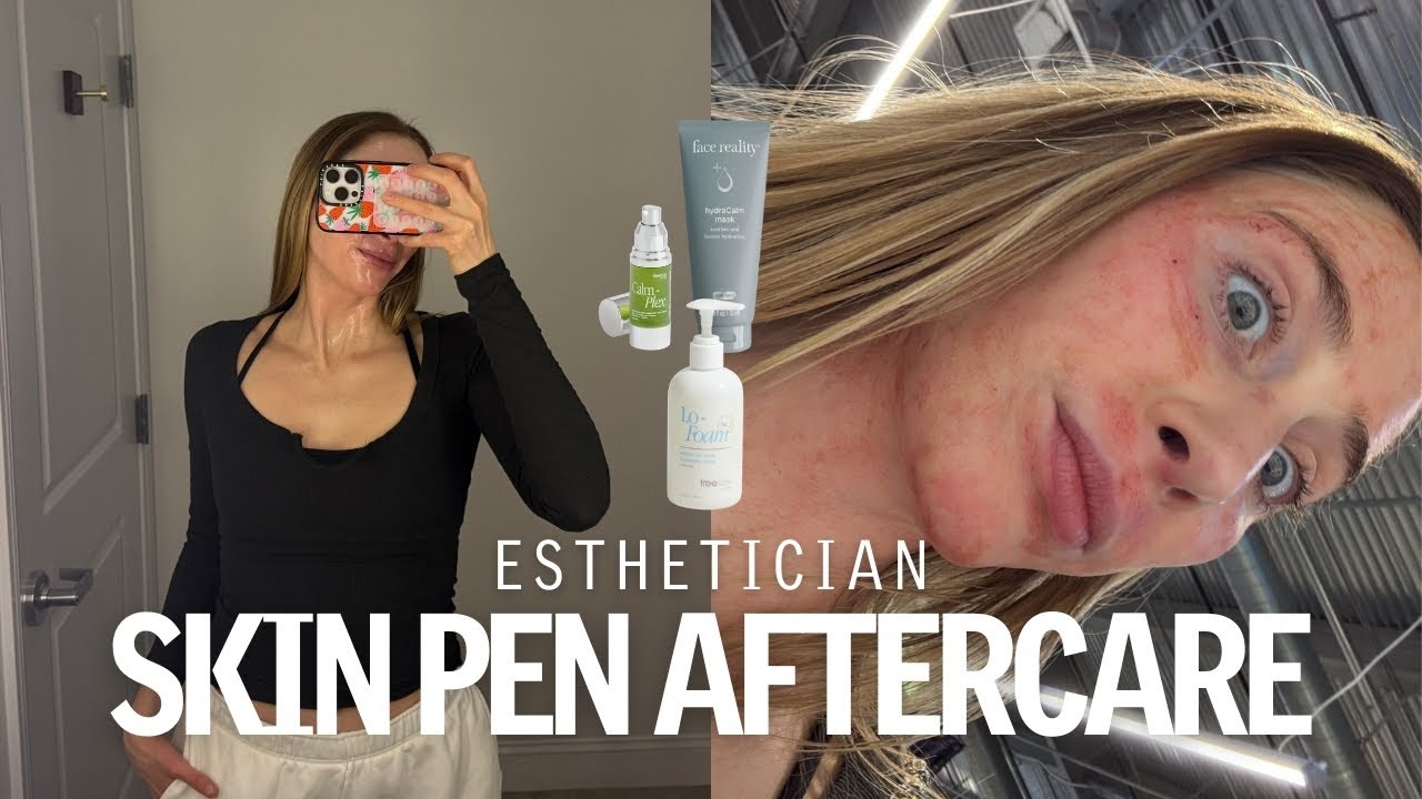 My post-microneedling skincare (gentle staples for damaged barrier
