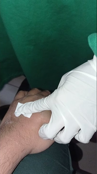 Mencabut selang infusan dari tangan