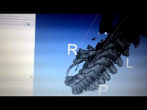 Segmentation & 3D Model Construction using 3D slicer