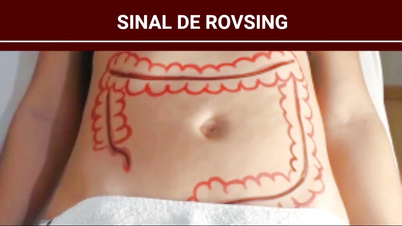 Signe De Rovsing Définition , La douleur abdominale Comprendre et ...