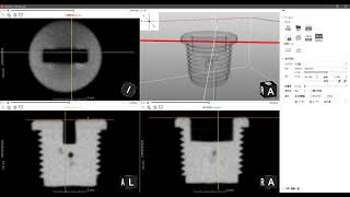 Screw (Plastic)：3D slices movie