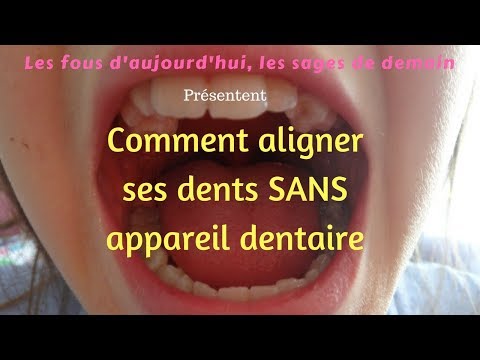 Vídeo: Com Mantenir Saludables Les Dents De L’hàmster