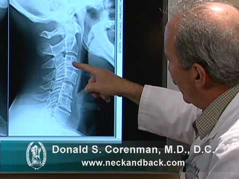 How to Read X-rays of the Cervical Spine (Neck) | Colorado Spine Expert