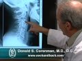 How to Read X-rays of the Cervical Spine (Neck) | Colorado Spine Expert