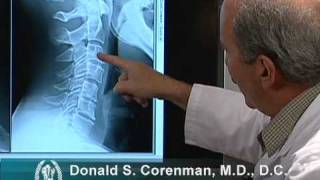 How to Read X-rays of the Cervical Spine (Neck) | Colorado Spine Expert screenshot 3