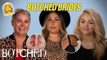 Botched Brides: Pulverized Noses, Extra Breasts and More?! (Before & After) | Botched | E!